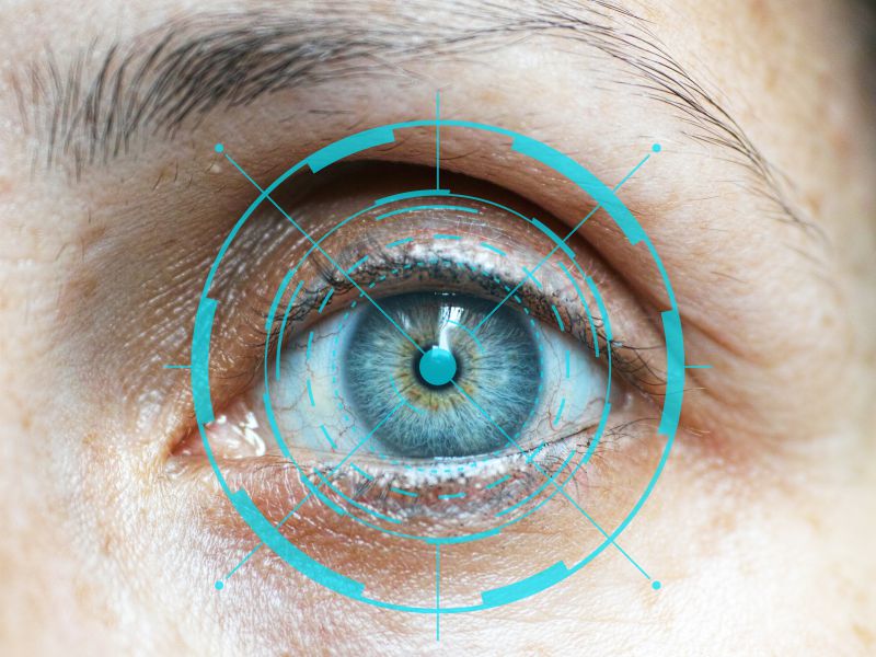 Você está visualizando atualmente Glaucoma: doença silenciosa que pode levar à cegueira